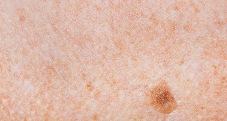 Dermatología clínica