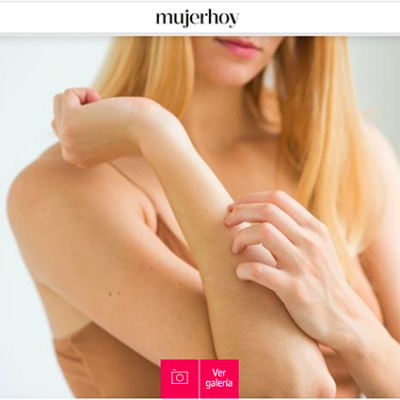 psoriasis psoriasis
